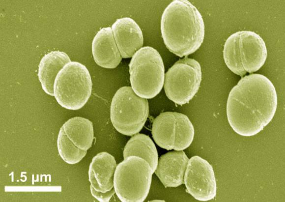 Planococcus halocryophilus Or1